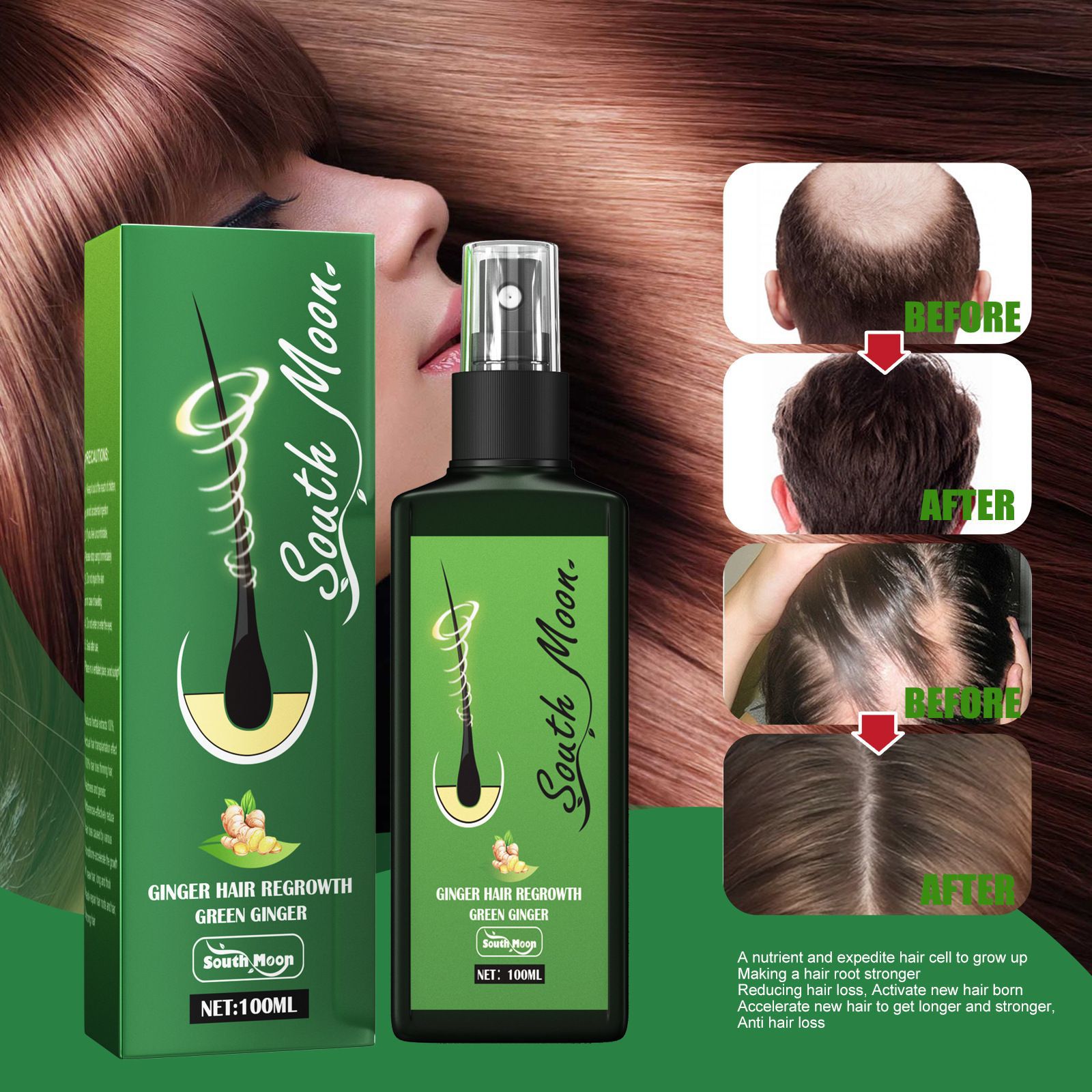 Spray per la Crescita dei Cape - Hair Care Frizzy Hair recensione e prezzo